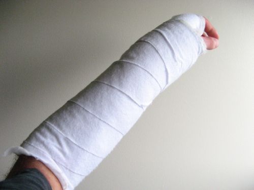 arm cast